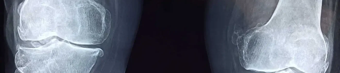 knee-g05d7044b0_1920